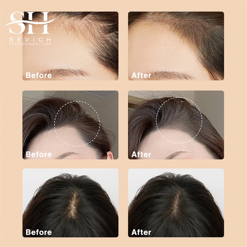 SEVICH 12g Hairline Powder Wit - Rooting Hormone Powder recensione e prezzo
